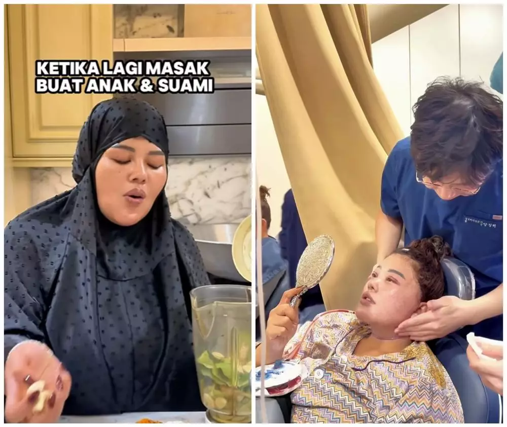 Shindy Samuel sebelum dan sesudah operasi plastik © Instagram Shindy Samuel sebelum dan sesudah operasi plastik © Instagram