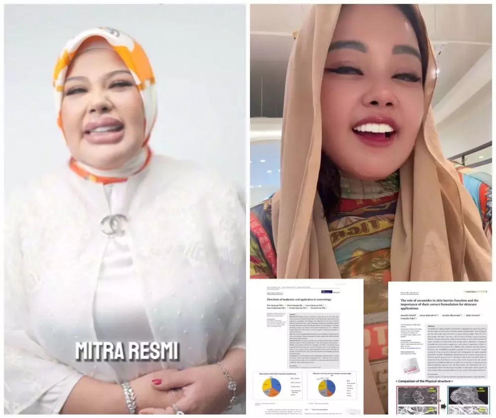 Shindy Samuel sebelum dan sesudah operasi plastik © Instagram Shindy Samuel sebelum dan sesudah operasi plastik © Instagram