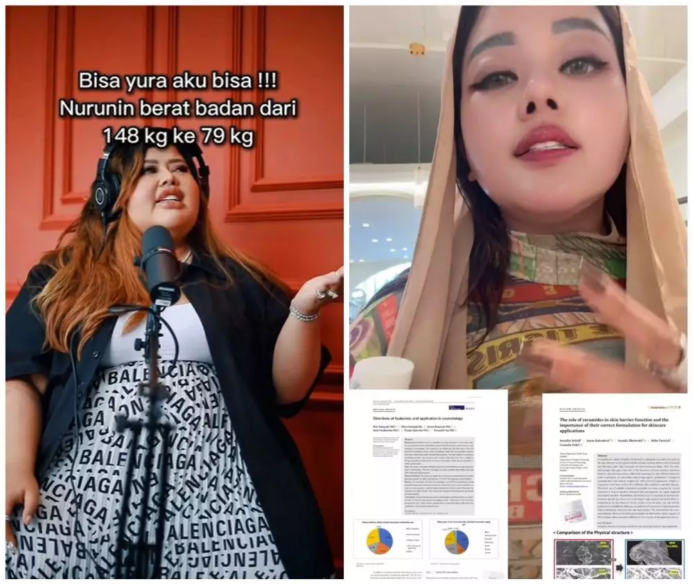 Shindy Samuel sebelum dan sesudah operasi plastik © Instagram Shindy Samuel sebelum dan sesudah operasi plastik © Instagram