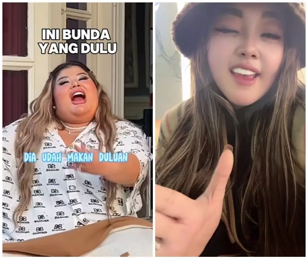 Shindy Samuel sebelum dan sesudah operasi plastik © Instagram Shindy Samuel sebelum dan sesudah operasi plastik © Instagram