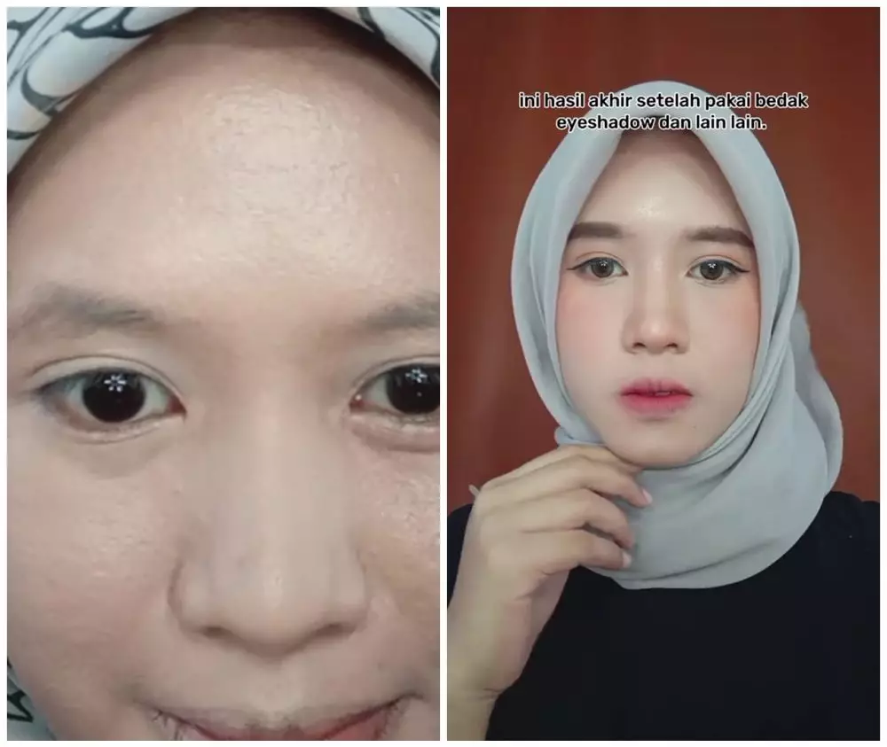 Cara mengatasi wajah berpori-pori besar (stok) © TikTok