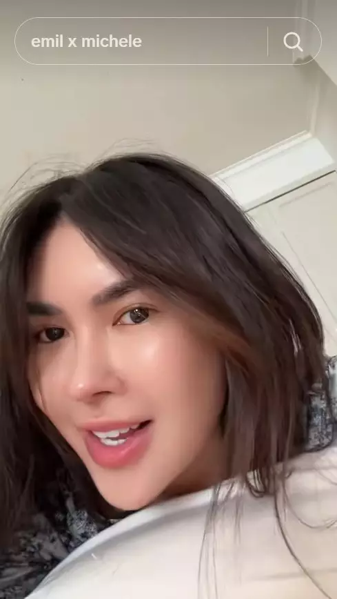 transformasi Michelle Halim sebelum dan sesudah pakai behel © 2025 brilio.net