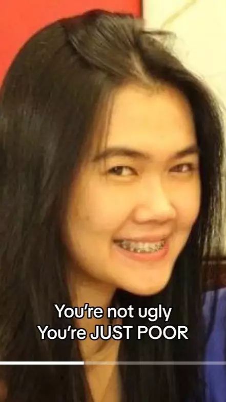 transformasi Michelle Halim sebelum dan sesudah pakai behel © 2025 brilio.net