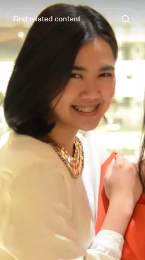 transformasi Michelle Halim sebelum dan sesudah pakai behel © 2025 brilio.net