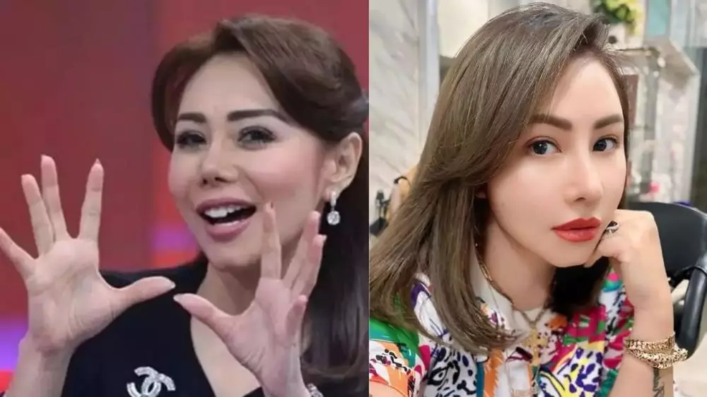 seleb sebelum dan setelah lakukan filler bibir (stok) © 2025 brilio.net seleb sebelum dan setelah lakukan filler bibir (stok) © 2025 brilio.net