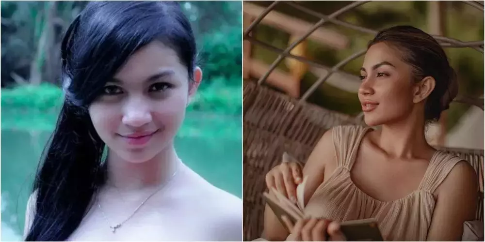 seleb sebelum dan setelah lakukan filler bibir (stok) © 2025 brilio.net seleb sebelum dan setelah lakukan filler bibir (stok) © 2025 brilio.net