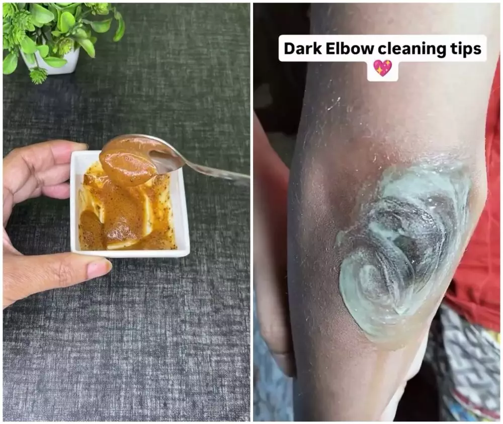 Cara cepat memutihkan siku © Instagram Cara cepat memutihkan siku © Instagram