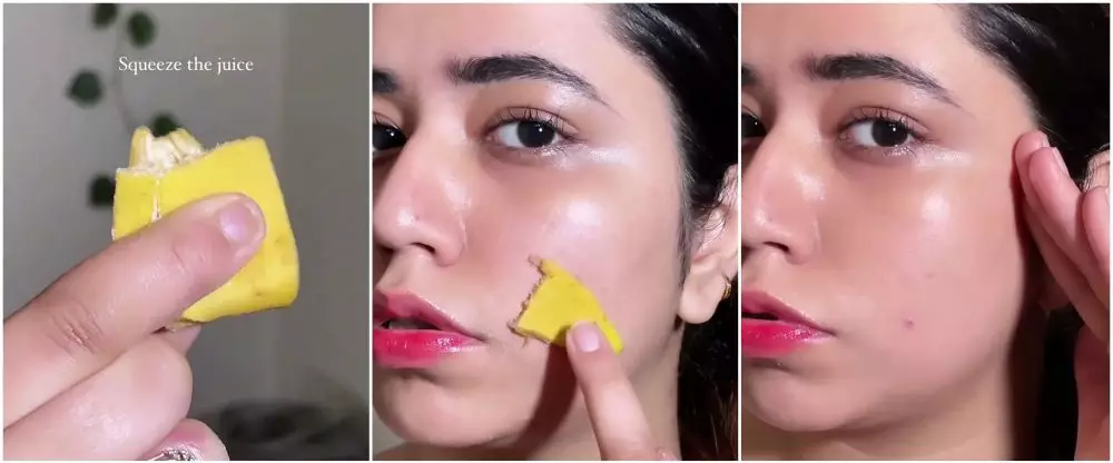 memudarkan bekas jerawat © i