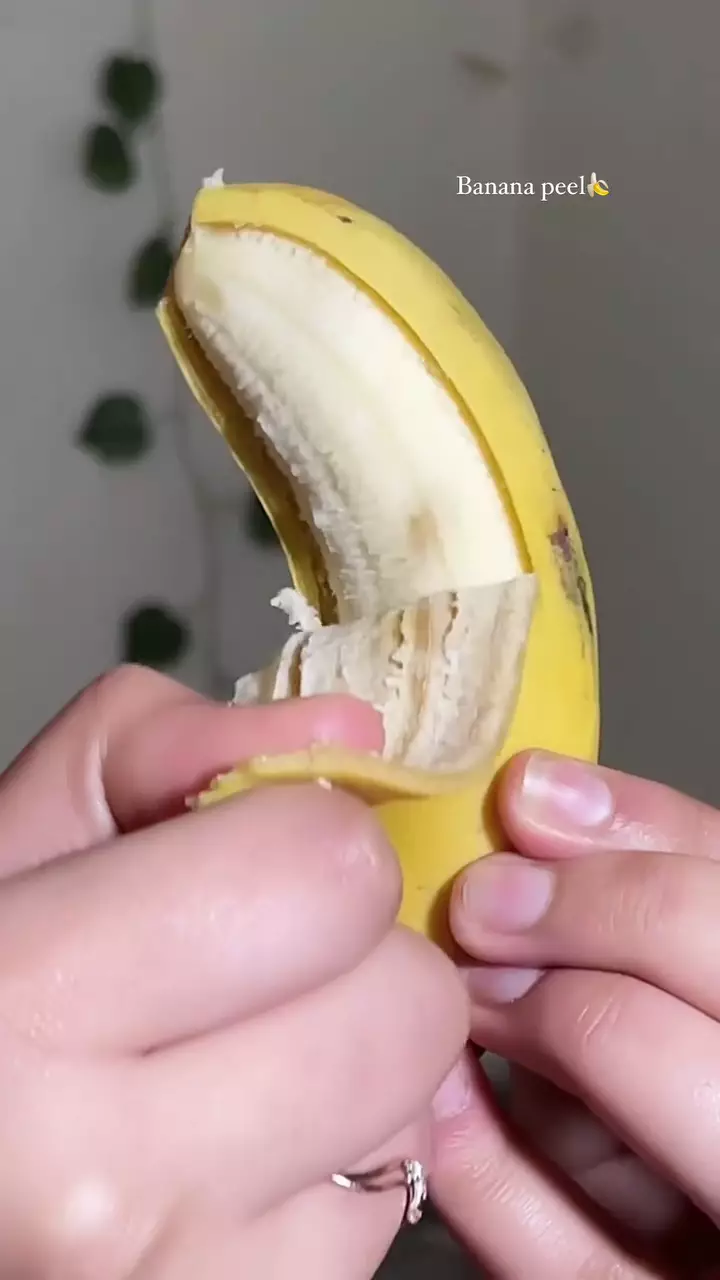 memudarkan bekas jerawat © i