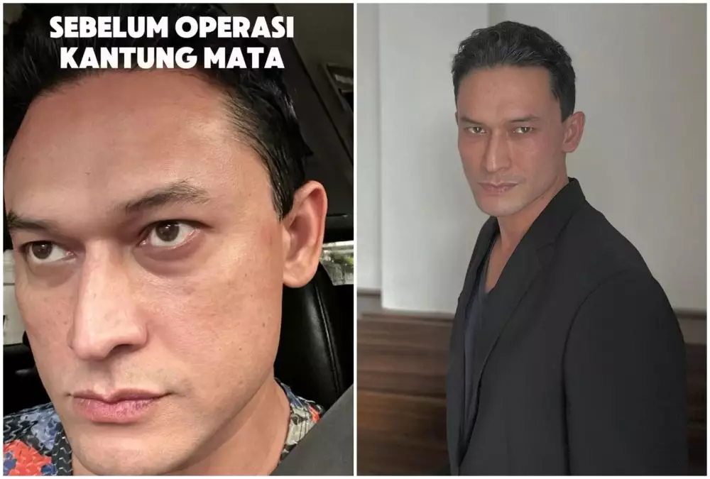 Transformasi Indra Bruggman © Instagram