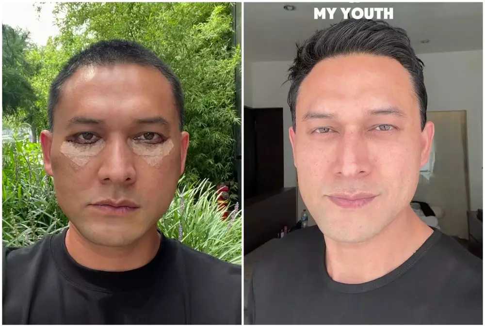 Transformasi Indra Bruggman © Instagram