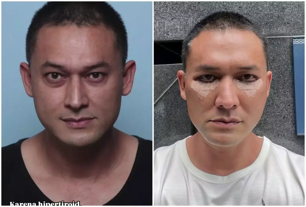 Transformasi Indra Bruggman © Instagram