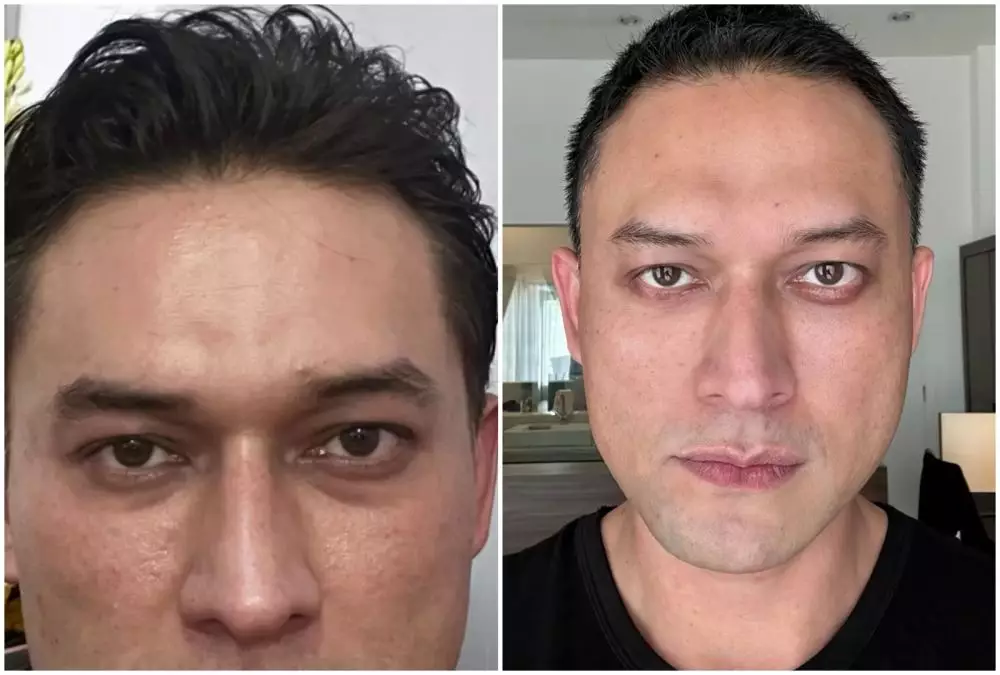 Transformasi Indra Bruggman © Instagram