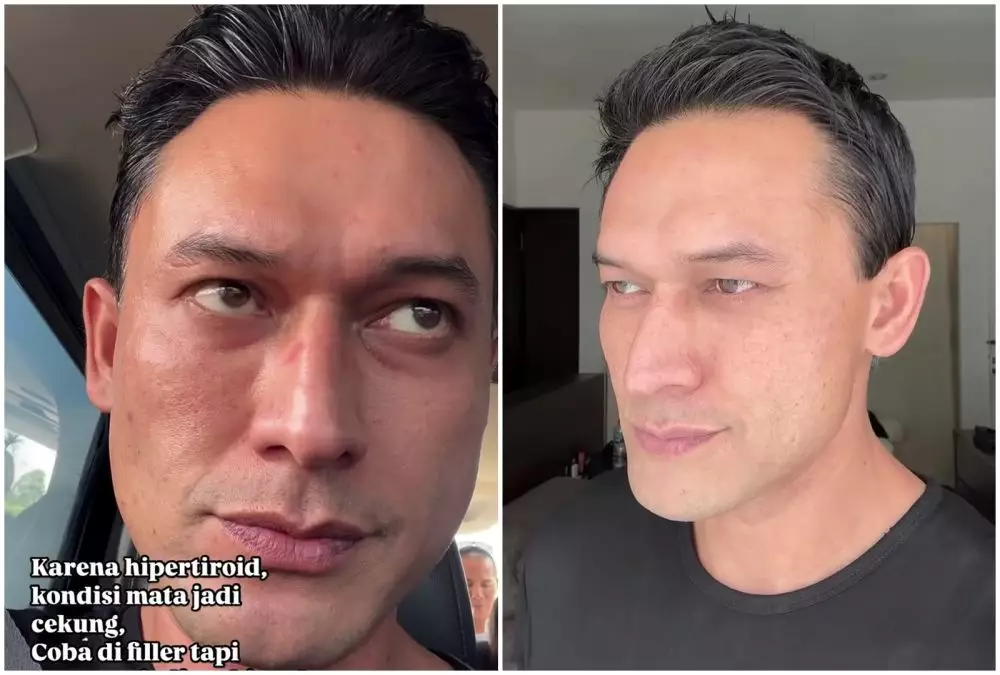 Transformasi Indra Bruggman © Instagram