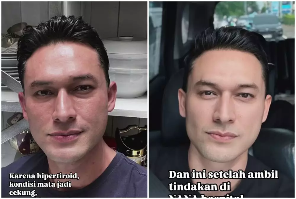 Transformasi Indra Bruggman © Instagram