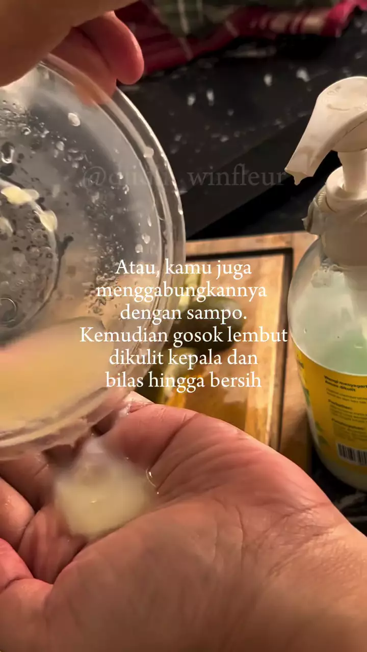 Cara membasmi ketombe © Instagram Cara membasmi ketombe © Instagram