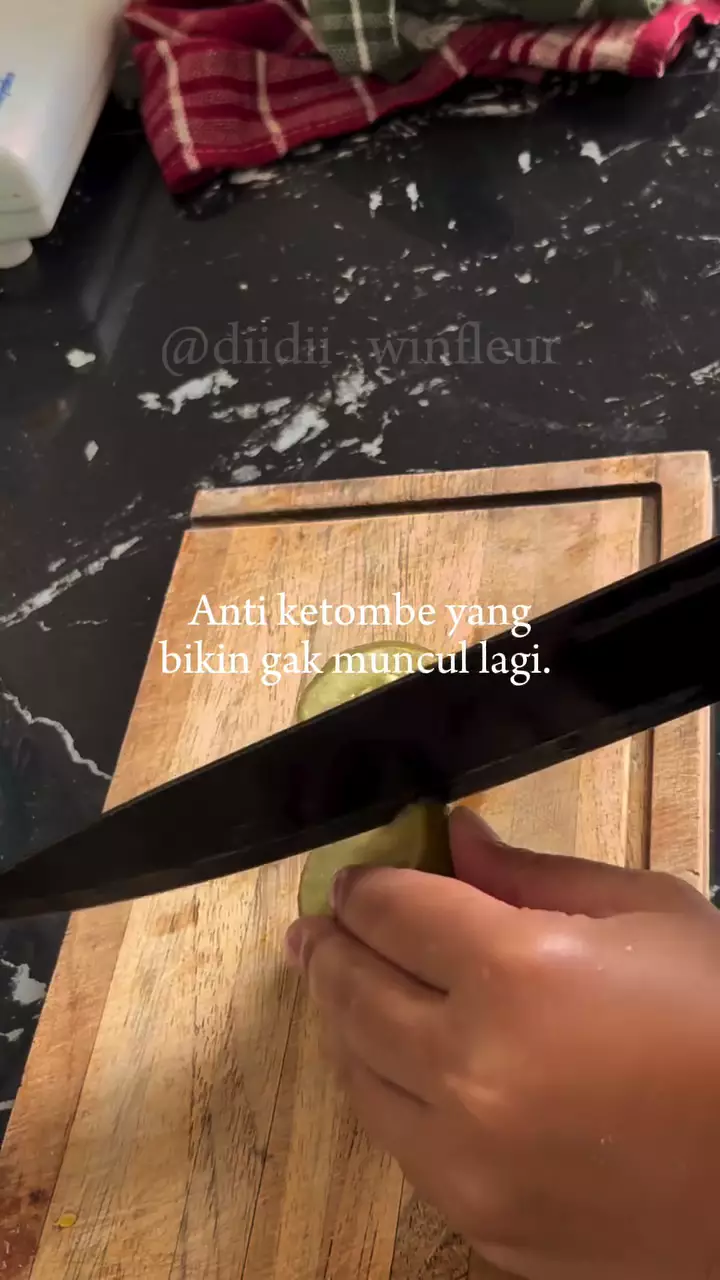 Cara membasmi ketombe © Instagram Cara membasmi ketombe © Instagram