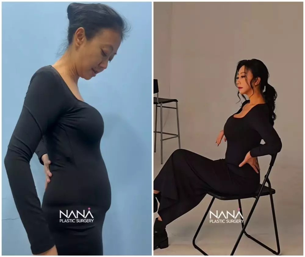 before-after Asri Welas © Instagram