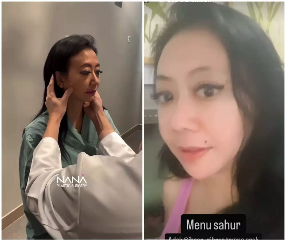 before-after Asri Welas © Instagram