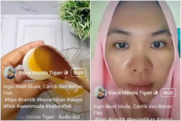 Wajah auto glowing tanpa skincare © 2025 brilio.net