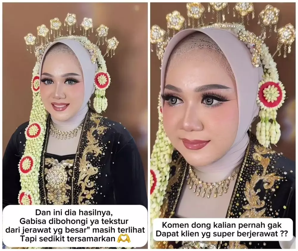 Transformasi makeup wanita berjerawat © TikTok
