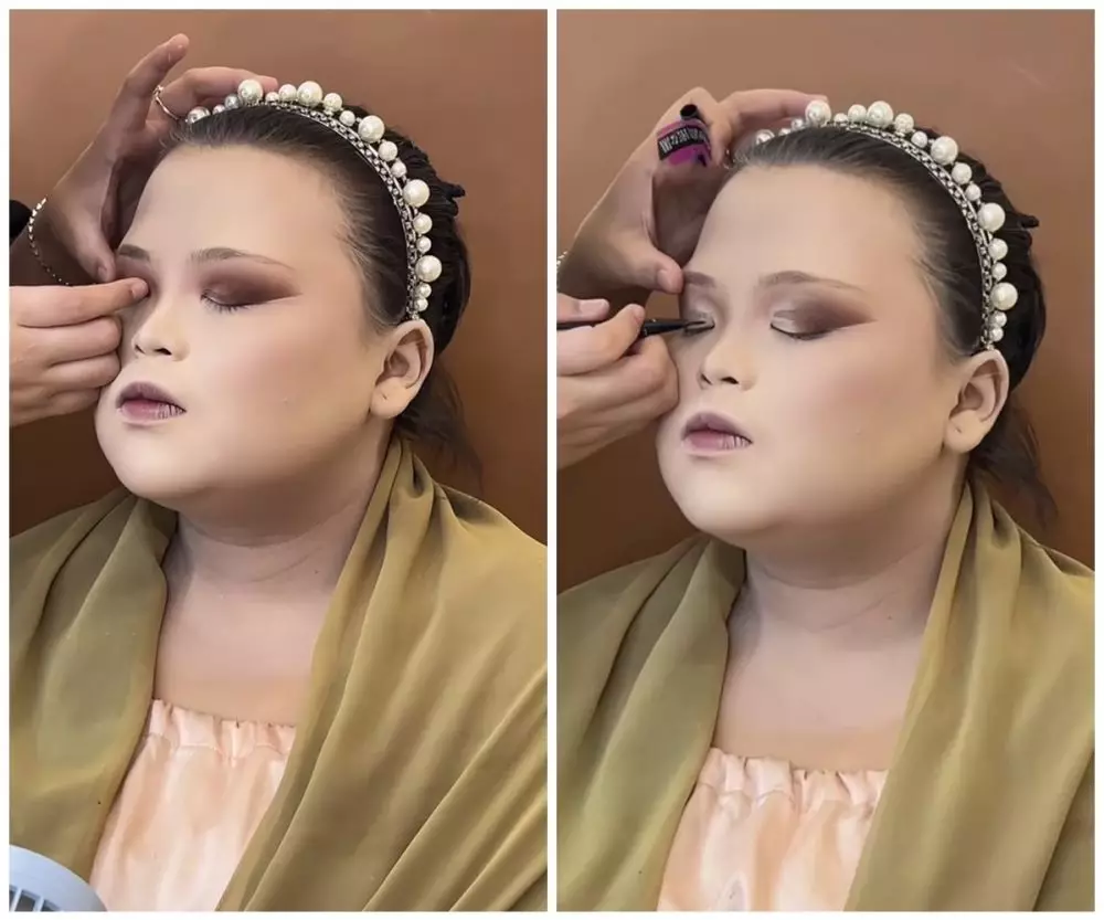 transformasi wajah tembam ini jadi tirus © TikTok