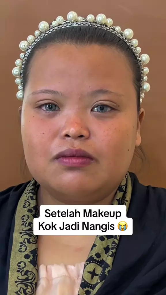 transformasi wajah tembam ini jadi tirus © TikTok