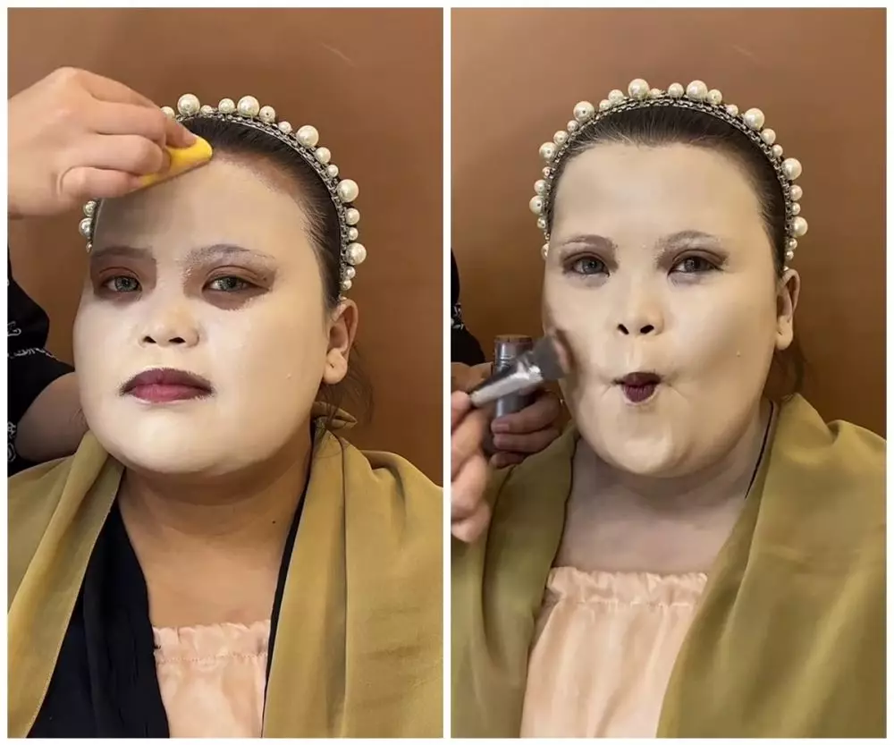 transformasi wajah tembam ini jadi tirus © TikTok