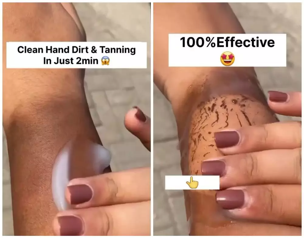 cara ampuh meratakan warna kulit belang © Instagram  cara ampuh meratakan warna kulit belang © Instagram