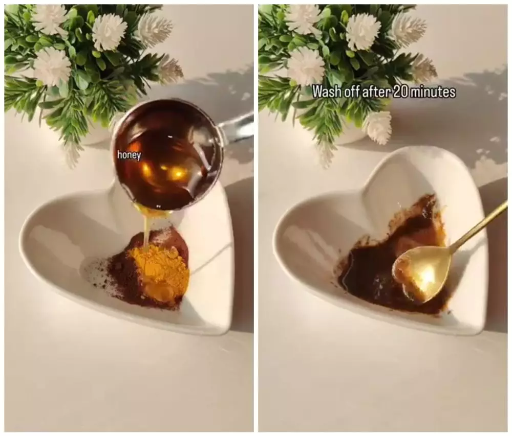 bibir gelap karena hiperpigmentasi © Instagram bibir gelap karena hiperpigmentasi © Instagram