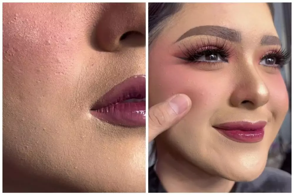 atasi foundation retak di area smile line © Instagram