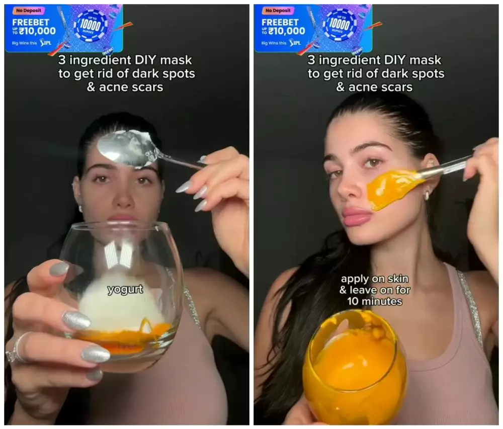 Flek hitam dan bekas jerawat auto minggat © Instagram