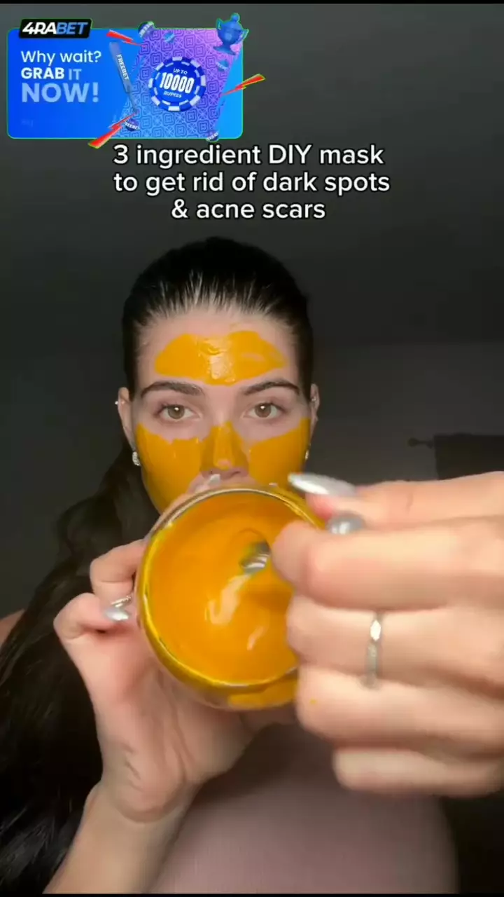 Flek hitam dan bekas jerawat auto minggat © Instagram