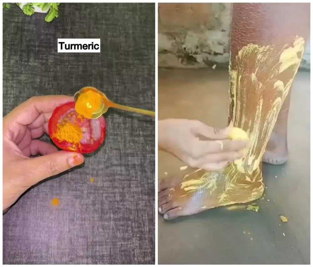 Kulit kering bikin pecah-pecah © Instagram Kulit kering bikin pecah-pecah © Instagram