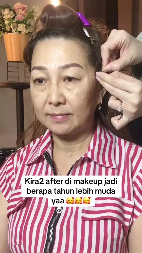 Mata sayu akibat kulit kendur © TikTok