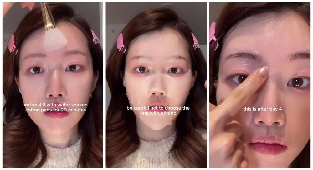 Cewek Korea ini bagikan rahasia hilangkan bruntusan © YouTube