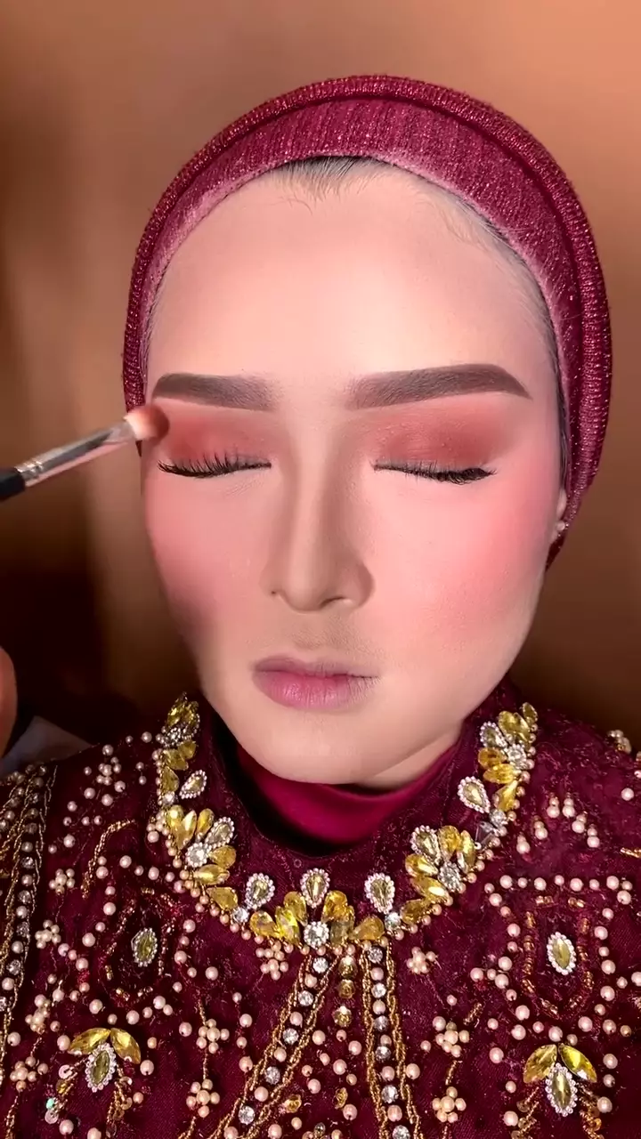 Wajah kemerahan akibat jerawat © Instagram Wajah kemerahan akibat jerawat © Instagram