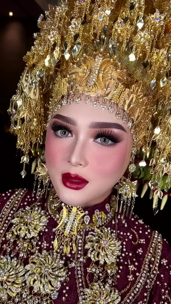 Wajah kemerahan akibat jerawat © Instagram Wajah kemerahan akibat jerawat © Instagram