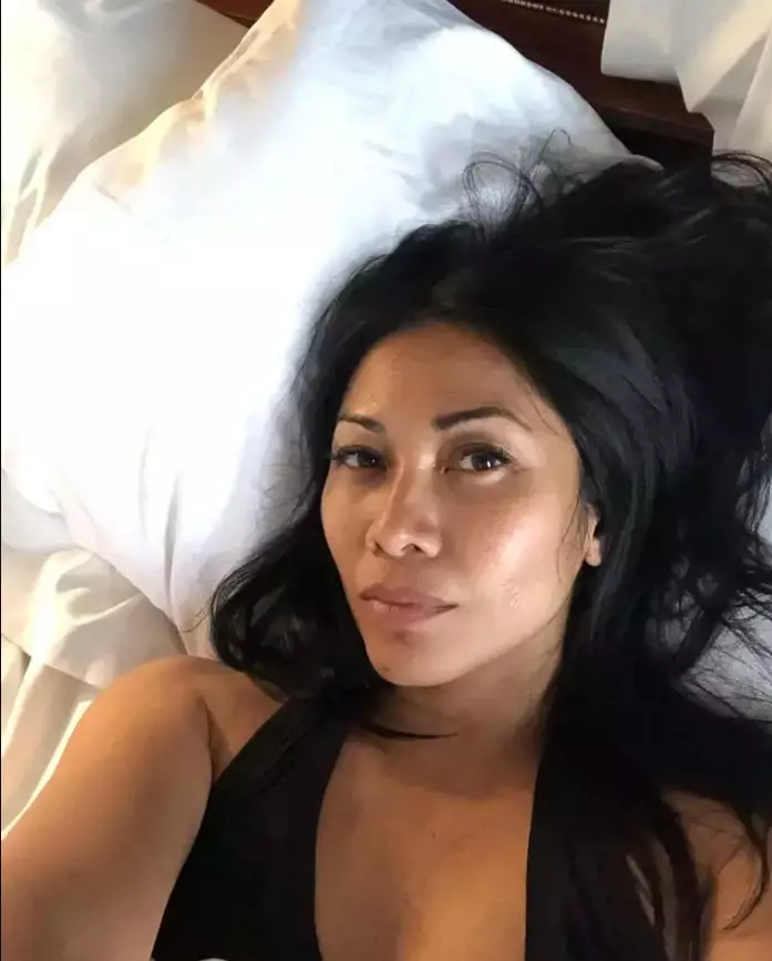 perawatan Anggun C Sasmi © Instagram perawatan Anggun C Sasmi © Instagram