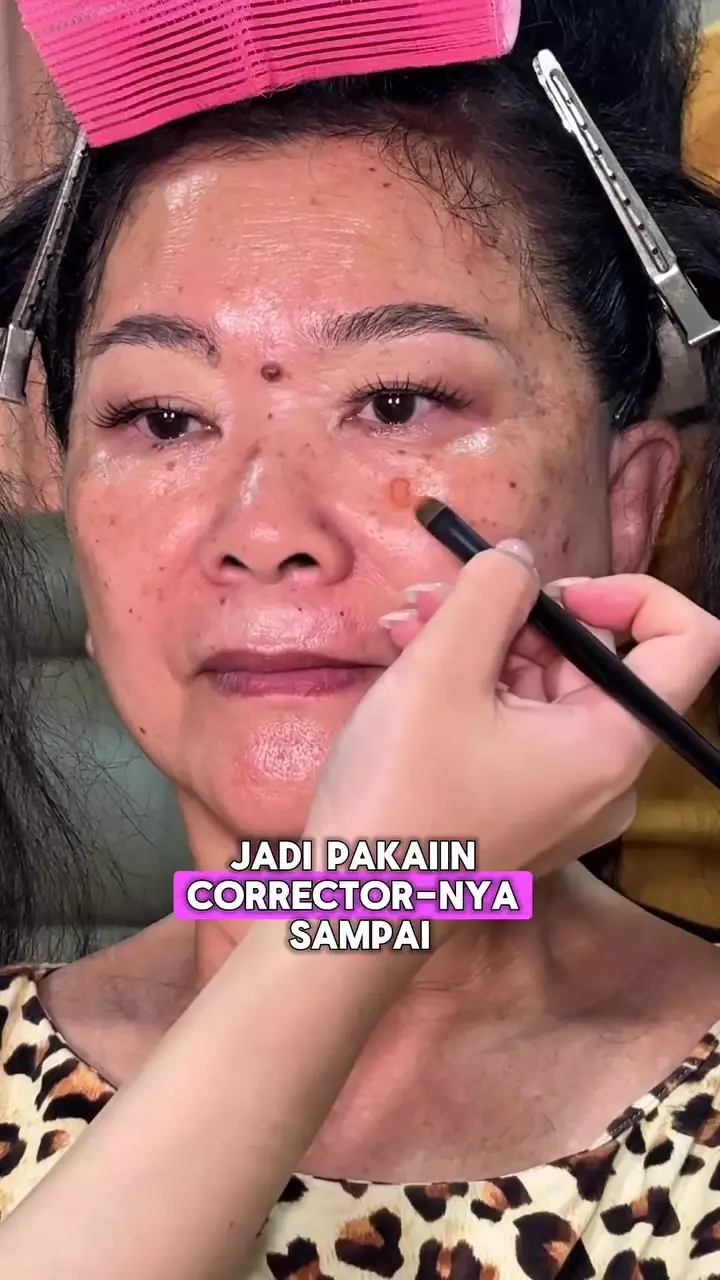 flek hitam pekat © Instagram