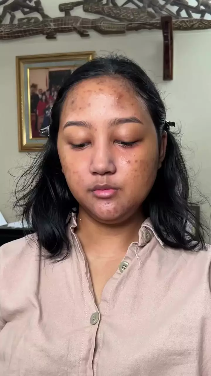remaja dengan bekas jerawat dirias soft glam © Instagram remaja dengan bekas jerawat dirias soft glam © Instagram