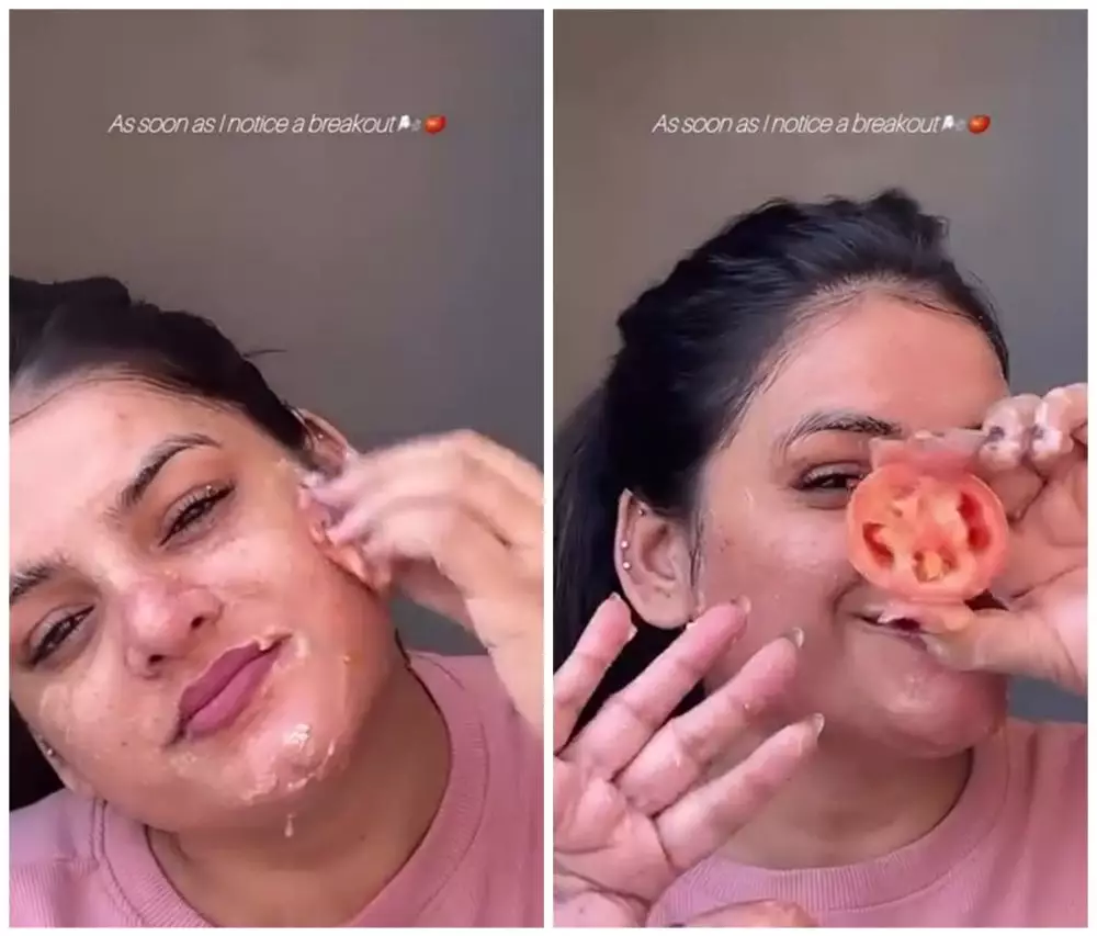 Wajah breakout jadi lebih mulus © Instagram Wajah breakout jadi lebih mulus © Instagram