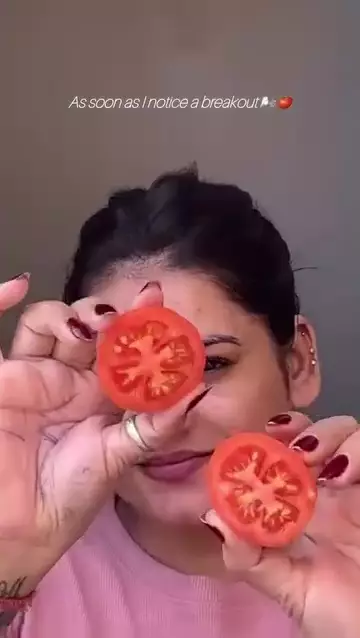 Wajah breakout jadi lebih mulus © Instagram Wajah breakout jadi lebih mulus © Instagram
