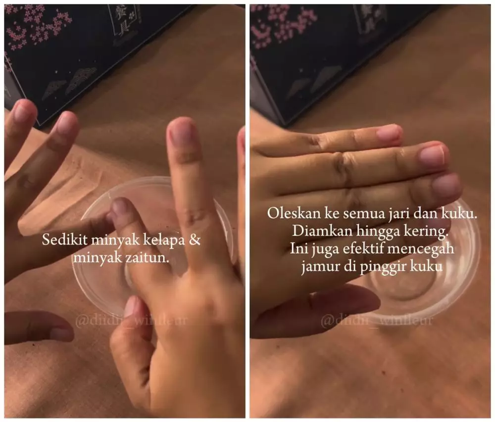 Kuku sering patah dan jamuran © Instagram