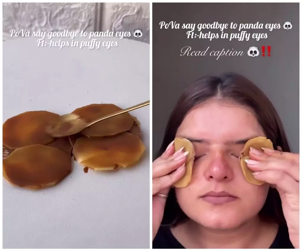 cara baru cerahkan kantung mata hitam © Instagram cara baru cerahkan kantung mata hitam © Instagram