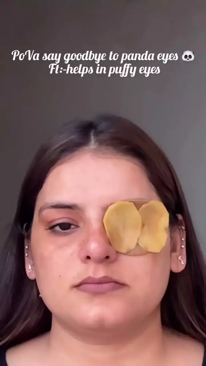 cara baru cerahkan kantung mata hitam © Instagram cara baru cerahkan kantung mata hitam © Instagram