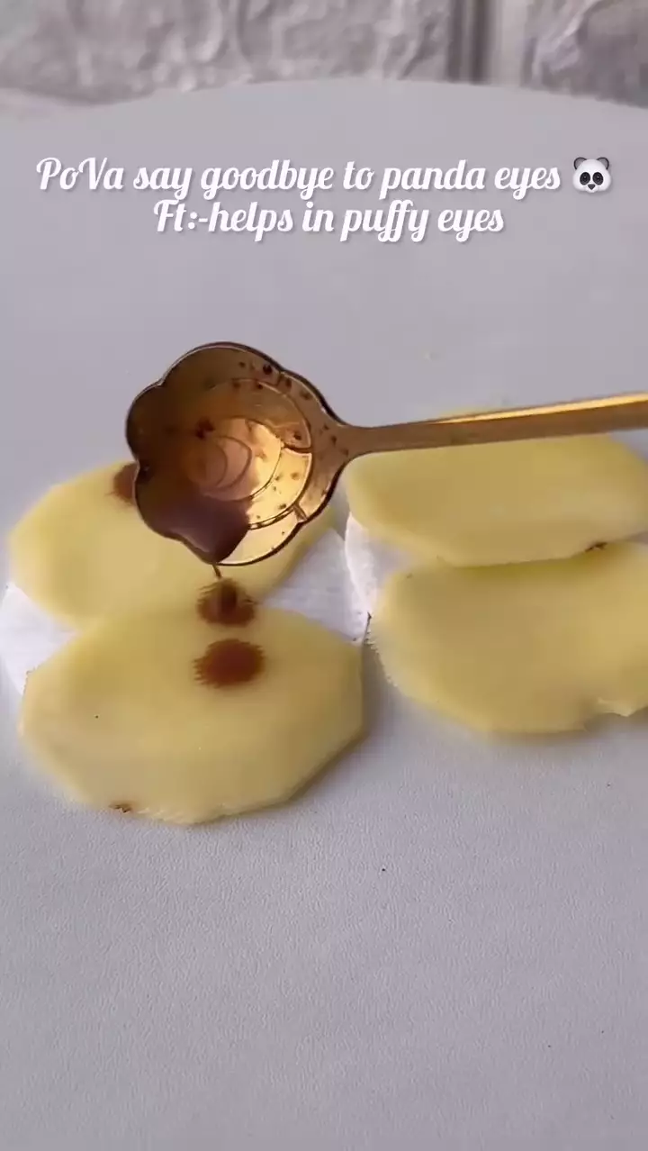 cara baru cerahkan kantung mata hitam © Instagram cara baru cerahkan kantung mata hitam © Instagram