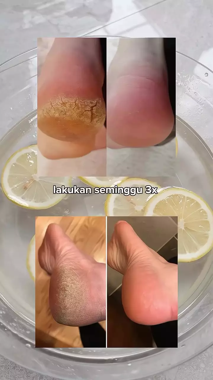 cara ampuh atasi kaki kering pakai minyak zaitun © Instagram