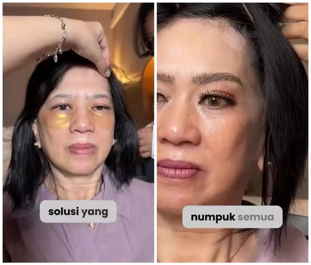 Transformasi ibu-ibu bermata sayu © Instagram Transformasi ibu-ibu bermata sayu © Instagram