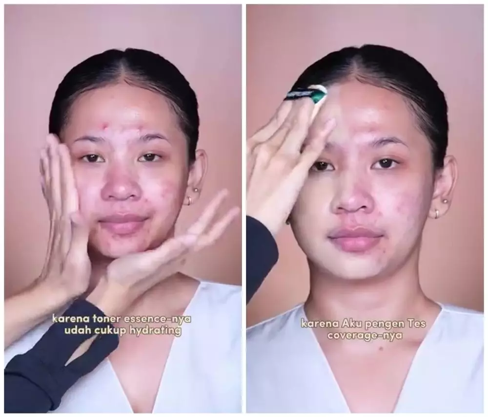 Kulit berminyak dan jerawatan dirias © Instagram